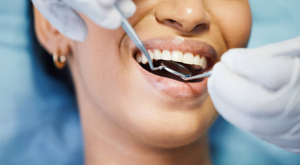 Best Knocked-Out Tooth (Avulsed Tooth) Treatment in Marble Falls, TX