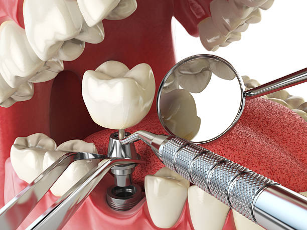 Best 24-Hour Emergency Dental Care in Marble Falls, TX