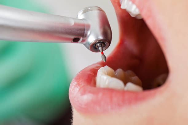 Best Walk-In Emergency Dental Services in Marble Falls, TX